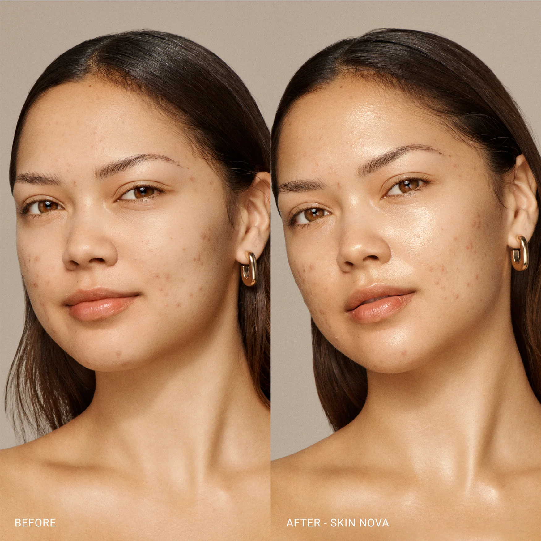 Skin Nova - Image 4