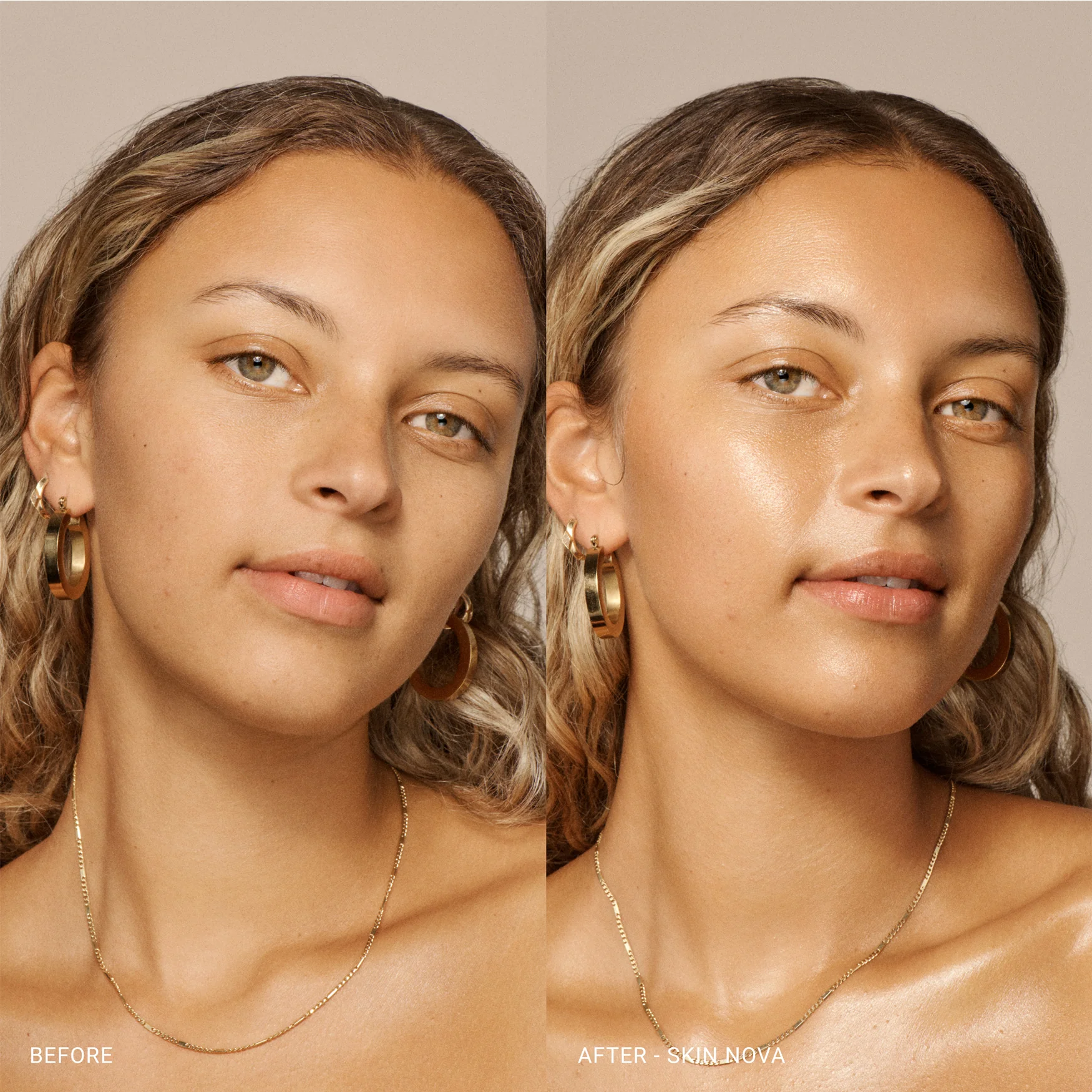 Skin Nova - Image 5