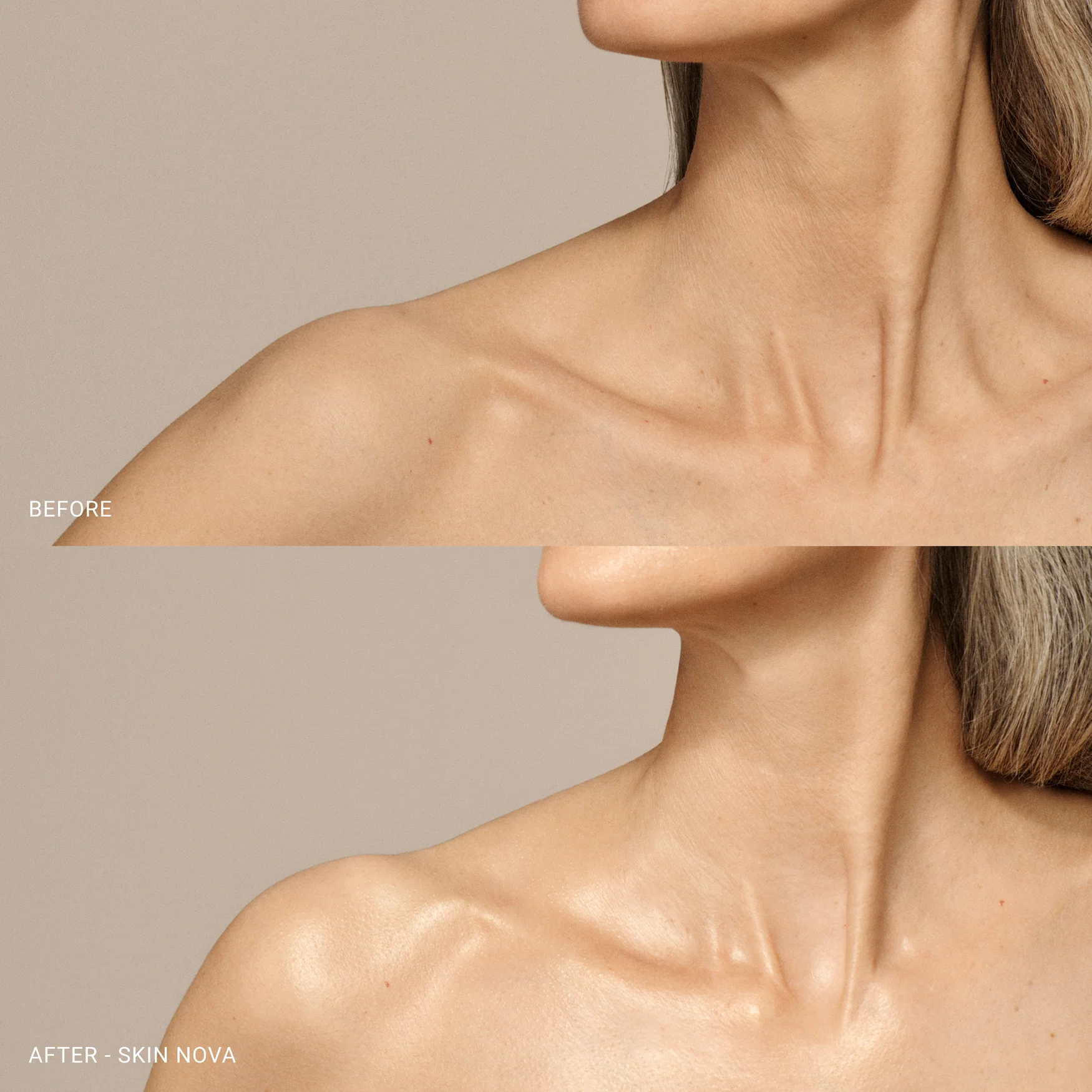 Skin Nova - Image 7