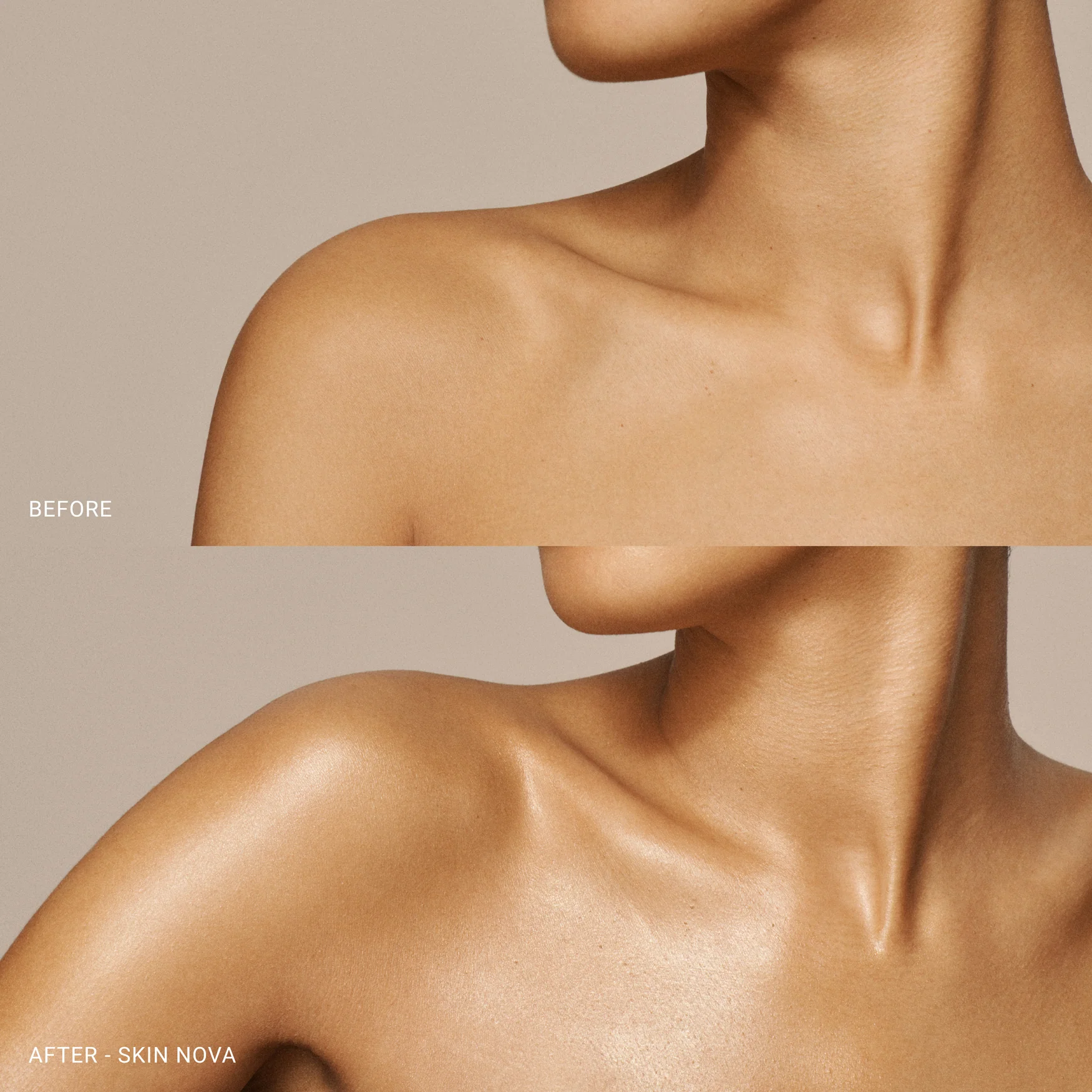 Skin Nova XL - Image 6